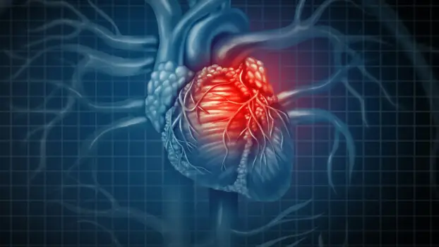 LIFE-HEALTH-HEART-MURMUR-DMT LIFE-HEALTH-HEART-MURMUR-DMT
